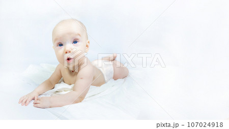 a baby with a hemangioma on his neck lies on a white background 107024918