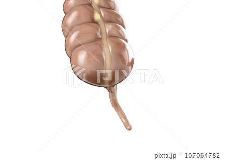 3d illustration of human appendix anatomy 107064782