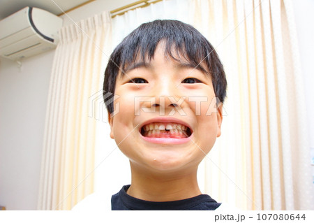 乳歯から永久歯への生え変わり 107080644
