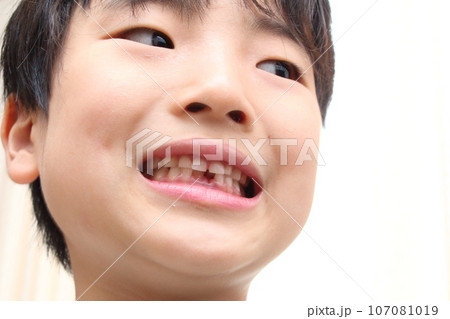 乳歯から永久歯への生え変わり 107081019