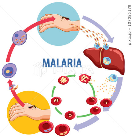 Science Education: Malaria Transmission Cycle Explained Through Illustrations 107085179