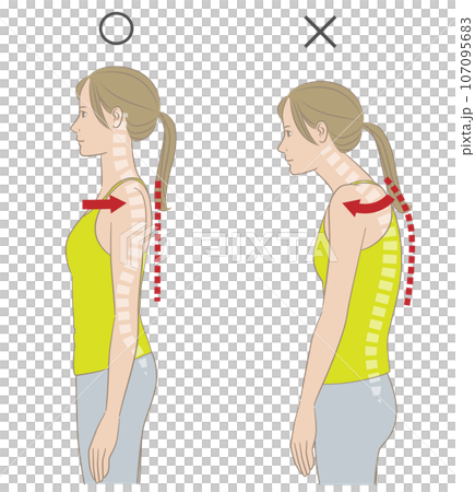 A woman with good posture and a woman with rolled shoulders and a stooped back 107095683
