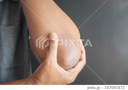 young man suffering pain on elbow young man suffering pain on elbow 107097872