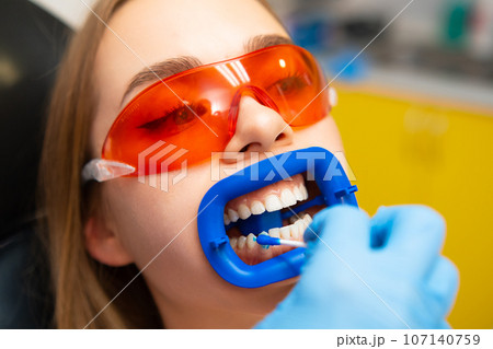 Dentist applies whitening gel to female patient, wearing orange protective goggles, teeth in the dental clinic  107140759