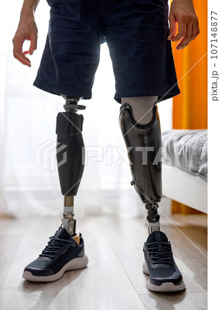 Disabled young man with leg prosthesis standing indoors at home, cropped photo Disabled young man with leg prosthesis standing indoors at home, cropped photo 107148877