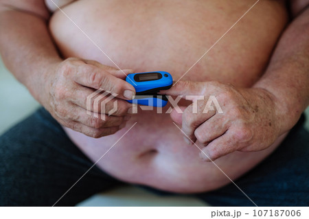 Overweight man iusing a pulse oximeter at home to measure blood oxygen saturation. 107187006