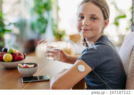 Close up of continuous glucose monitor sensor on girl's arm. 107187122
