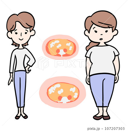 体内脂肪 内臓脂肪 皮下脂肪 体内脂肪 内臓脂肪 皮下脂肪 107207303