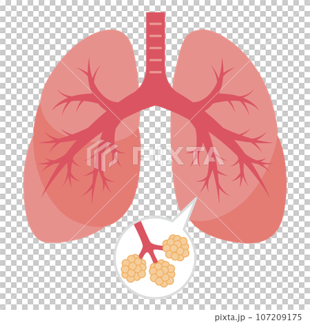 肺のイラスト 107209175