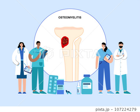 Tibia bone osteomyelitis 107224279