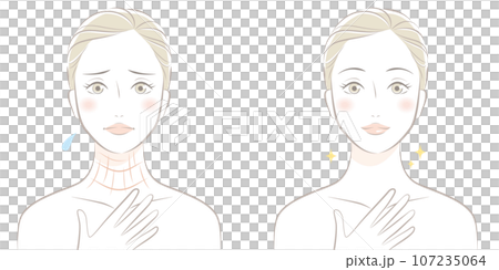 Before and after of a woman suffering from neck wrinkles 107235064