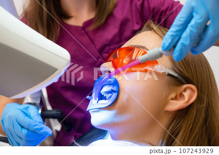 Close up dentist uses saliva ejector while doing a professional whitening of teeth for young patient Close up dentist uses saliva ejector while doing a professional whitening of teeth for young patient 107243929