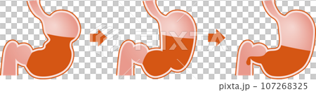 胃蠕動圖 107268325
