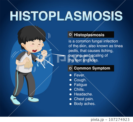 Informative poster of Histoplasmosis Informative poster of Histoplasmosis 107274923