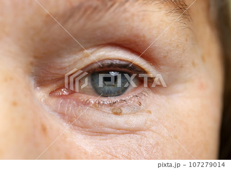 Charming lady and facial picture Charming lady and facial picture 107279014