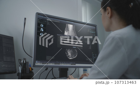 Female doctor examines results of mammography on computer 107313463