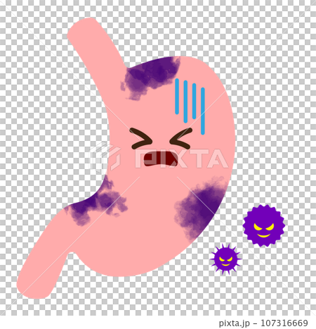 胃がん、癌細胞をイメージしたイラスト 胃がん、癌細胞をイメージしたイラスト 107316669