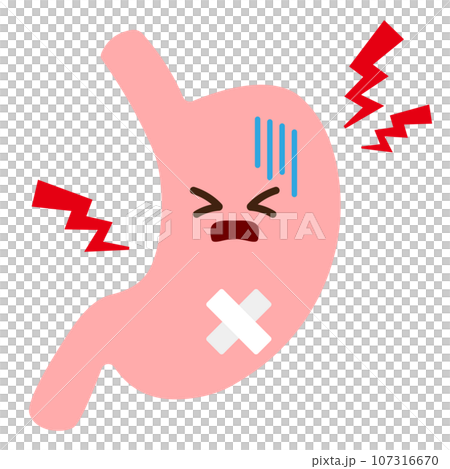 胃炎をイメージしたイラスト 胃炎をイメージしたイラスト 107316670
