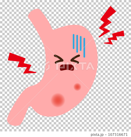 想像胃炎和胃潰瘍的插圖 107316671