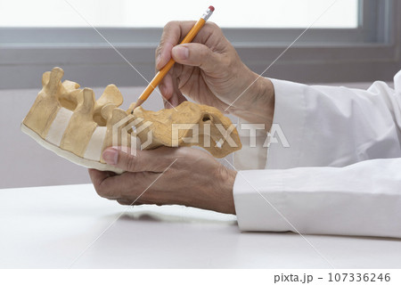Doctor demonstrating lumbar spine model Doctor demonstrating lumbar spine model 107336246
