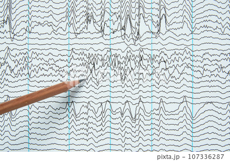 Imaging of electroencephalography recording of human 107336287