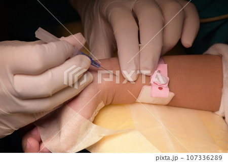 Doctor inserting the needle for arterial line Doctor inserting the needle for arterial line 107336289
