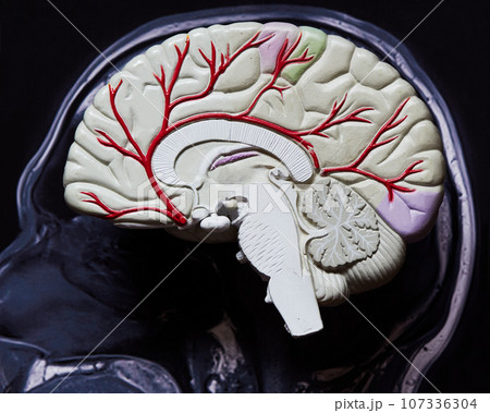 Brain model and brain MRI 107336304