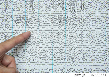 Pointing at imaging of human electroencephalography recording 107336331