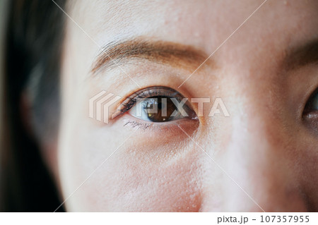 30代女性の目 107357955