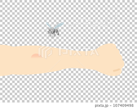 虫刺されのイラスト 107409498