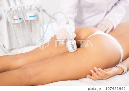 Cosmetologist using cold hammer during hardware procedure on female buttocks 107421942