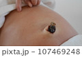 Newborn baby's belly button stump With drying umbilical cord. 107469248