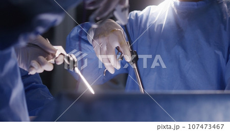 Close up of medics using laparoscopy instruments during surgery 107473467
