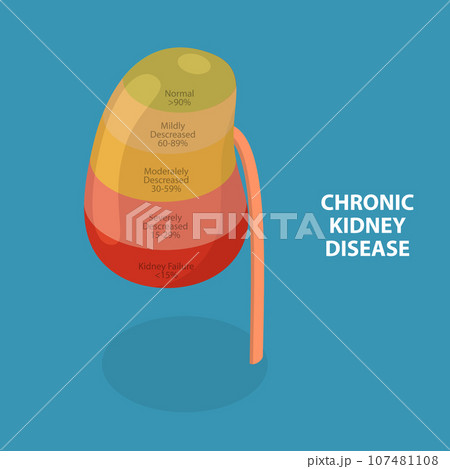 3D Isometric Flat Vector Conceptual Illustration of Chronic Kidney Disease 107481108