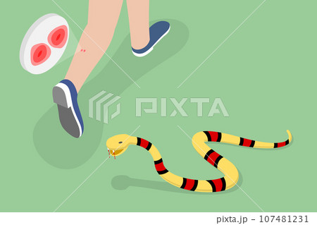 3D Isometric Flat Vector Conceptual Illustration of Poisonous Snake Bit 3D Isometric Flat Vector Conceptual Illustration of Poisonous Snake Bit 107481231