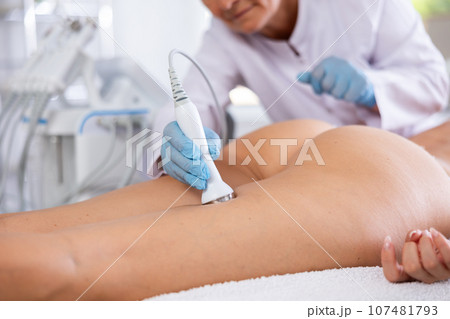 Anti aging thigh hardware therapy procedure for young female client in clinic of aesthetic medicine 107481793