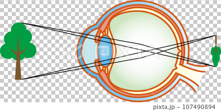 遠視 眼睛結構 107490894