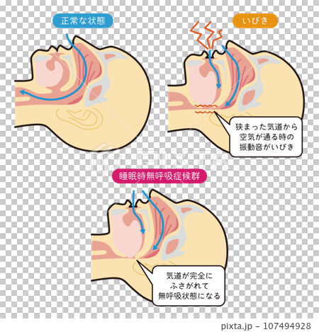 Illustration explaining breathing during sleep 107494928