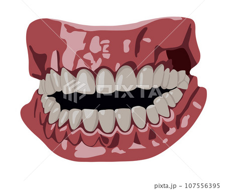 Vector isolated illustration of human jaw with...のイラスト素材 [107556395 ...