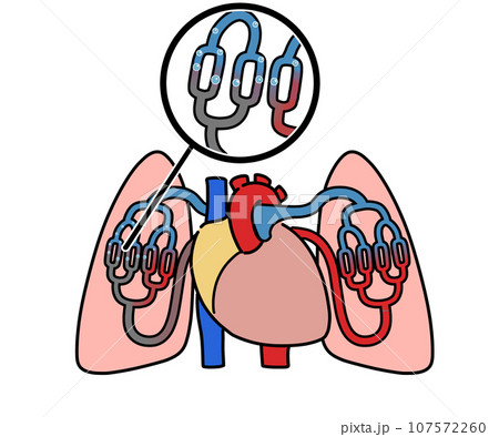 肺空気塞栓 107572260