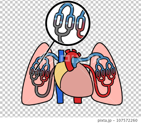 肺空気塞栓 107572260