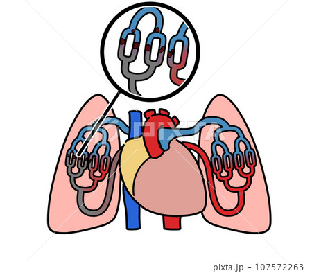 肺血栓塞栓 107572263