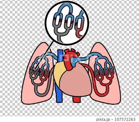 肺血栓塞栓 107572263
