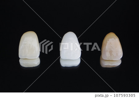 前歯セラミッククラウン 107593305