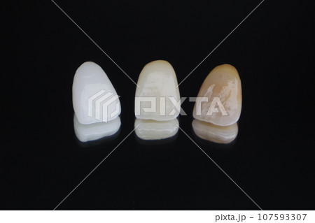 前歯セラミッククラウン 前歯セラミッククラウン 107593307