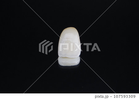 前歯セラミッククラウン 107593309