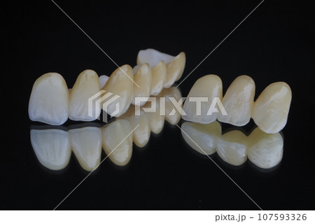 オールセラミッククラウンブリッジ 107593326