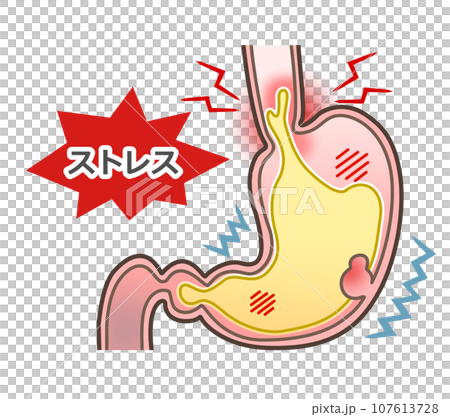 Stomach rotting due to stress 107613728