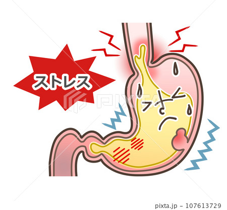 ストレスでボロボロの胃 107613729