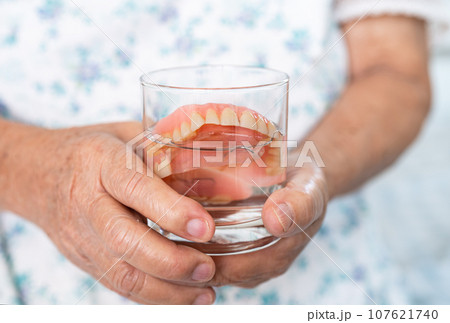 Asian senior woman patient holding and washing denture in water cleanser glass for good chewing. Asian senior woman patient holding and washing denture in water cleanser glass for good chewing. 107621740